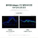 인셀덤스페셜 | [2+1 할인 행사 마감 임박] “인셀덤 더마톨로지 크림 후기｜자이언트 병풀·리포좀 공법으로 탄력...