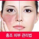 수니스킨케어 - 김제시 | 수니스킨케어