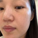 인셀덤티나(Tina) | 인셀덤 부작용?? 수부지 지성피부 기초 관리, 결과는 내돈내산 - 원흥역 인셀덤 티나