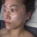 [강남구청 에스테틱 추천] 빛나 에스테틱에서 피부과 대신 리버스 에이징 관리 받은 후기