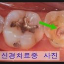스마일홍치과의원 네이버블로그