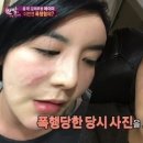 에이미