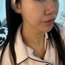 메디클린 | 메디앤유 멀티리프팅 알파 후기｜피부수분관리 되는 가성비홈케어 뷰티디바이스