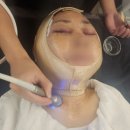 엄마의 집 효도급식소 | 강남안면거상 엄마한테 효도 제대로 한 하안검, 안면거상술 후기