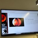 내맘에한의원 | 강남비염한의원 알레르기비염 치료 부비동염 효과 후기