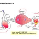 Muscle Attack | [드림널스 챌린지] 12주차 Coronary artery disease (CAD) and acute coronary syndrome (ACS)~