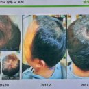 친환경머리염색 전문샵 | 노은 디톡두피케어 머리염색샵 후기