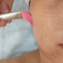 휴어학원 | 하남피부관리 퓨어H에스테틱 여드름스켈링 관리 후기