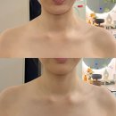 하일리 | W25. 대구 승모근 수기마사지 신부관리 에스테틱 맛집 '하일리에스테틱' 후기(내돈내산)