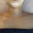 민트테라피