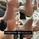 뮬량네일더뷰티 - 서구 도솔로 346-1 | [대전] 대전발각질관리 “뮬량네일 the beauty” 방문후기