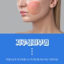 누리정수시스템