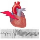 부정맥이란~ 이미지