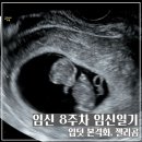임신일기 임신 8,9주차 증상 입덧 시작, 임신선물, 하리보 젤리곰