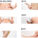 시리폰
