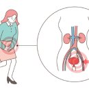 남녀 방광염의 증상과 예방 이미지