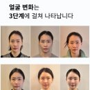 청담코어디자인헬리오스지점 | 울쎄라? 경락? 진짜 얼굴작아지는법