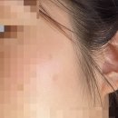 룩스미의원 네이버블로그