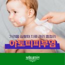 어린이 아토피 치료 관리 총정리 (가려움 심할때)