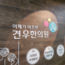 ﻿월상골연화증, 한의원에서 빨리 치료되는 이유? 이미지