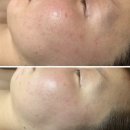 서윤피부맑음 명동점