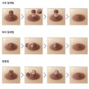 생각보다 존나 다양한 유두 성형수술법...jpg 이미지