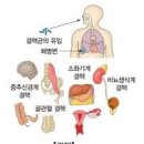 결핵 이란? 원인과 증상, 전염과 완치 여부 이미지