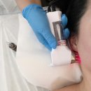 미담케어 | 천안바디관리 두정동 미담왁싱 바이오포톤 후기