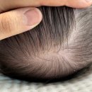 다산제일약국 | [2개월] 3월 육아 일기 ㇱ (50일 셀프촬영/2개월 예방접종/다산삼성프라임 소아과)