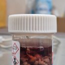 서울탑비뇨기과의원 | ​[건강기록] 을지로 이윤수 비뇨기과, 전립선 비대증 수술(TURP) 생생 후기