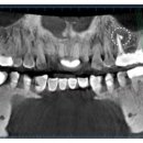 자연알로(성남) 이미지