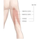 다운스윙스타트에서 벌떡 일어서는 것은 ㅡ 허벅지 좌우 내측광근과 외측광근 이미지