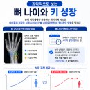 영락유치원 | TMIㅣ초등 아들 성장판 검사 후기, 예상보다 빨랐던 성장 속도와 앞으로의 계획