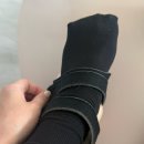 지변 | 발가락수술 철심제거, 새끼발가락 수술 철심제거, 수술후기, 만곡지변형, 발가락휨 수술, 수술후기 기록