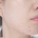 매쓰케어 | 시바산 재생크림 매쓰크림 에스테틱화장품 후기