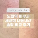 선한한의원 | 노원역 한의원 여드름 피부과 새살침 내돈내산 솔직 후기
