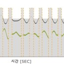 드림보청기 네이버블로그