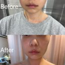 민씨한의원 네이버블로그