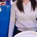 압구정리치모아의원 | 유라인클리닉 지방분해주사 후기, 팔뚝컷주사 1회차