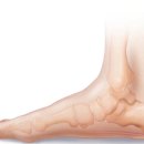 연세바른마취통증의학과의원 | 방화동 통증의학과 봄철 야외활동 방해하는 발뒤꿈치 통증 원인 알아보기