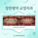 장한평역 교정 치과 5분만에 끝내는 완벽 로드맵