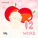 CU  이대목동병원점 | [둥이임신12주차] 귀울림 / 이대서울병원 니프티 / 목투명대 / 아스피린 / 람다사인 / 입체초음파