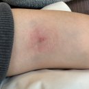 경기도 수원시 권선구 덕영대로1201번길 42 (권선동) | 공포의 임당검사 후기