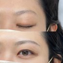 일차로 | [성수동눈썹문신/건대자연눈썹] 꼼꼬미브로우 눈썹문신 일차별 후기(짱구눈썹안됨!!!)