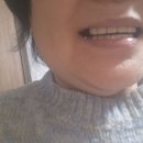 박정동치과 Daum카페