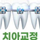 능치과의원 네이버블로그