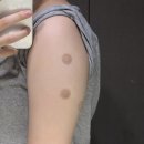 닥터쁘띠의원 | 건대 닥터쁘띠의원 지방파괴주사