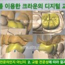 윤디지털치과기공소 이미지