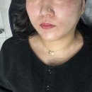 강남역 스킨부스터 연어주사 젤성형외과 방문 후기