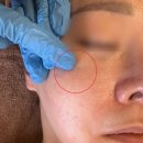 해천사우나 | 진해 모공관리 여드름 흉터 색소 침착관리는 천방케어로